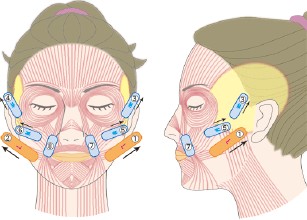 埋线提升除皱让你无惧岁月催人老